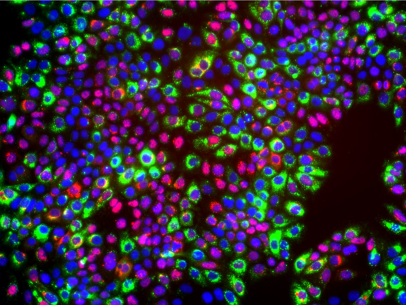 infected Huh7 cells (RNA FISH HDV RNA, Immunostaining of HBV S protein)